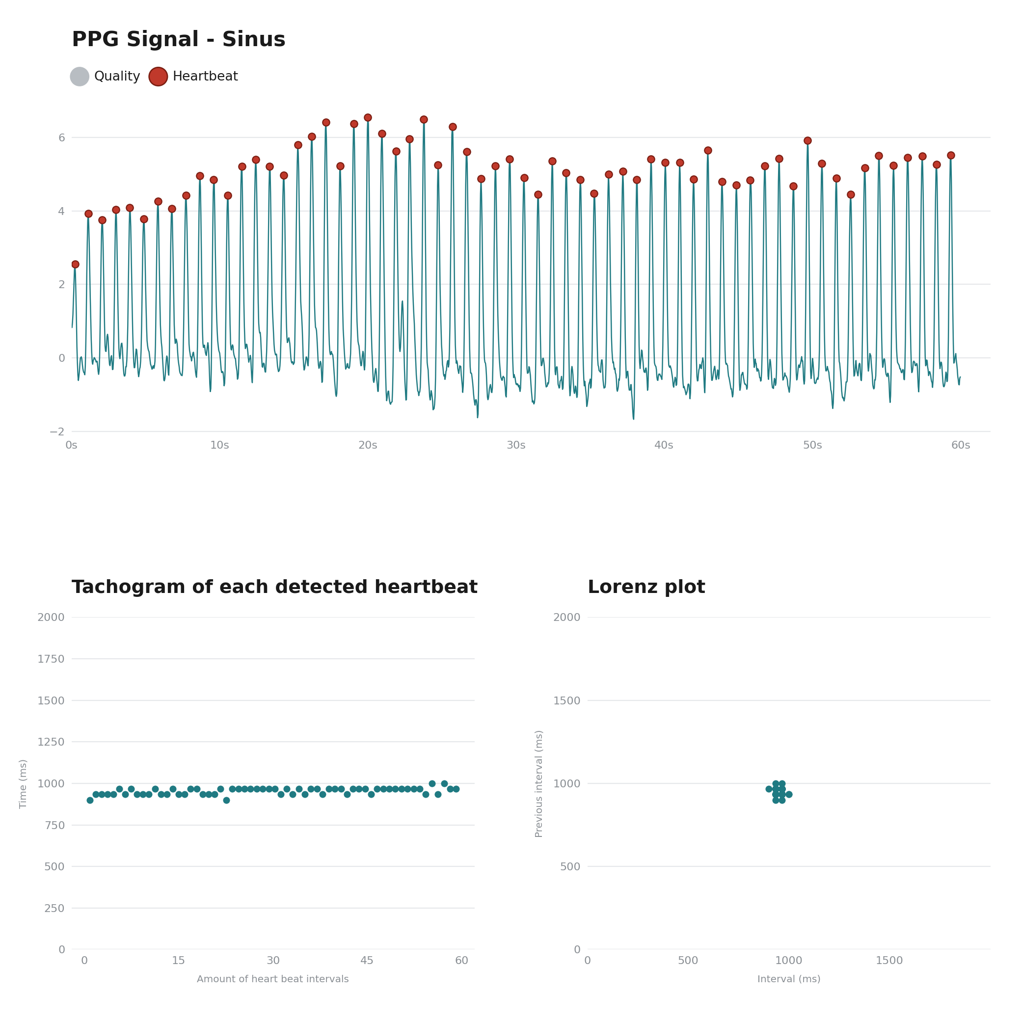 PPG-analyse van een regelmatig sinusritme