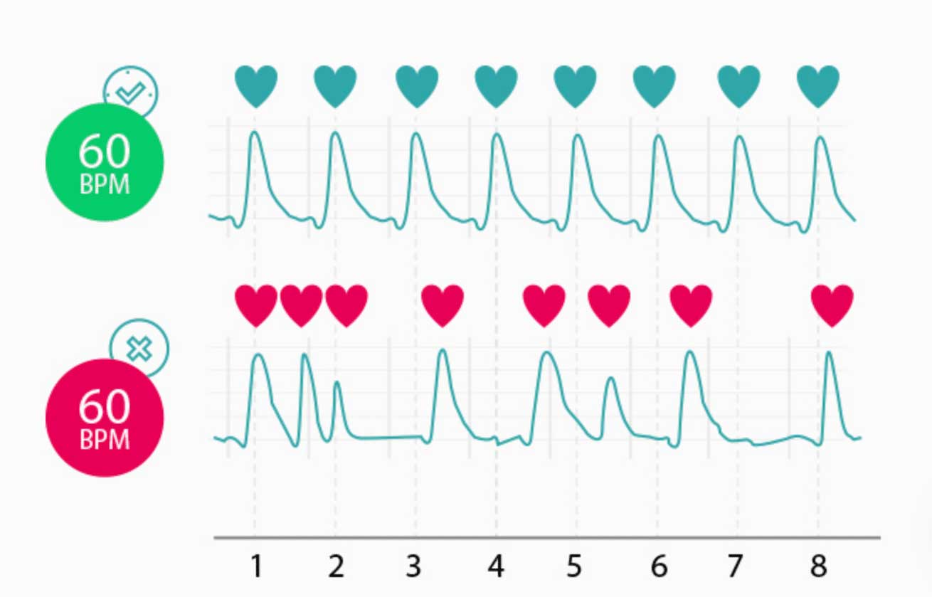 Heart rate versus heart -